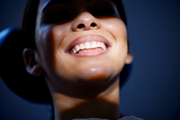 dental implants los angeles