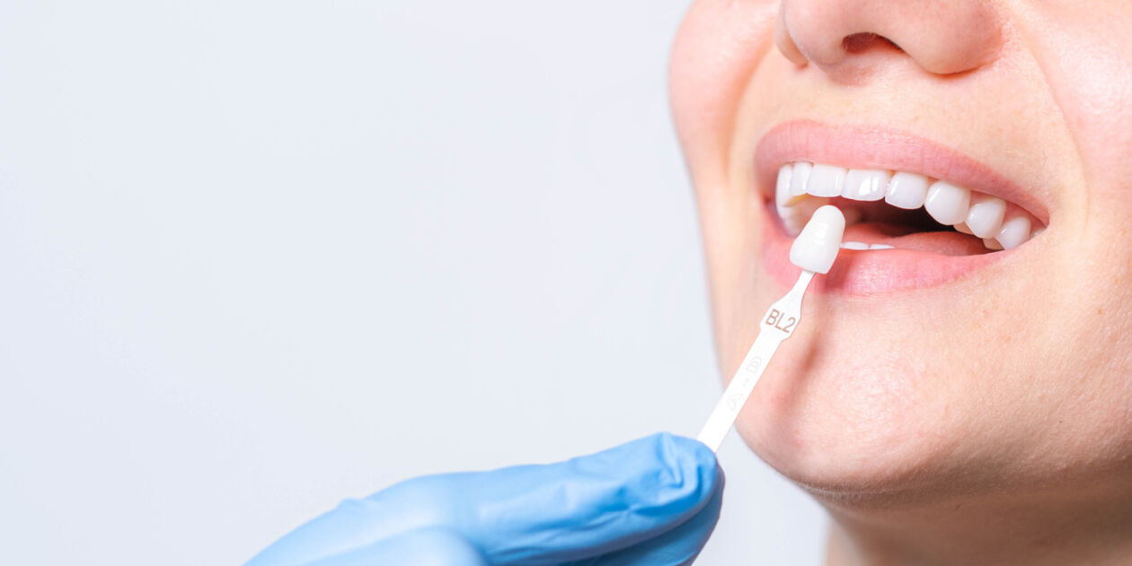 Los Angeles cosmetic dentist