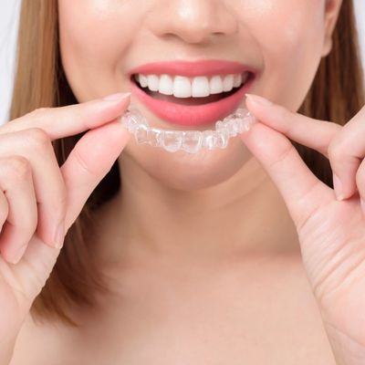 Invisalign’s Mechanism is what