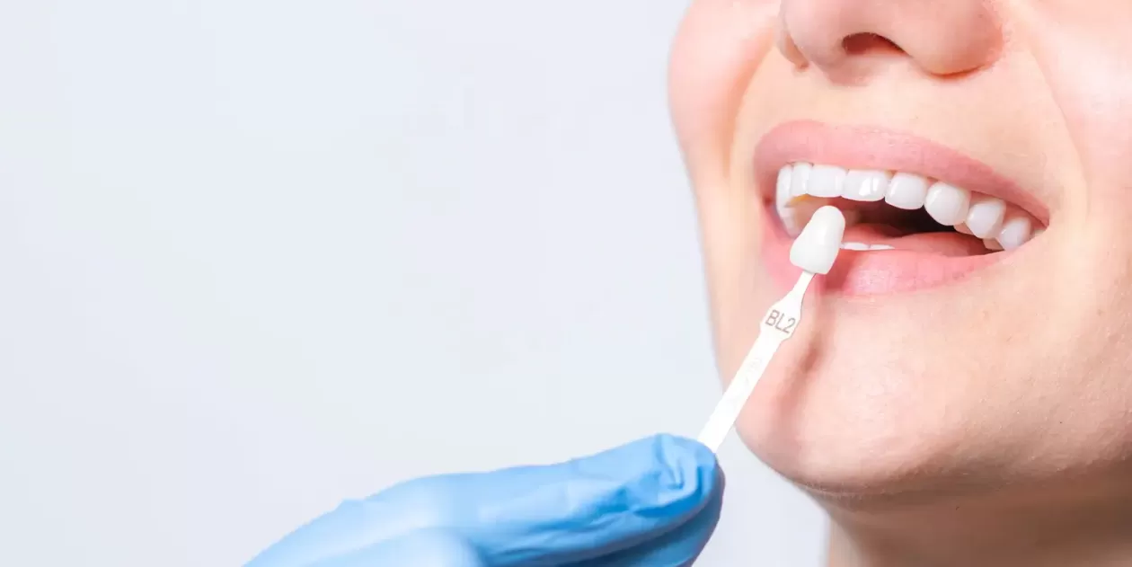 Cosmetic Dentistry Secrets to Keep Your Teeth